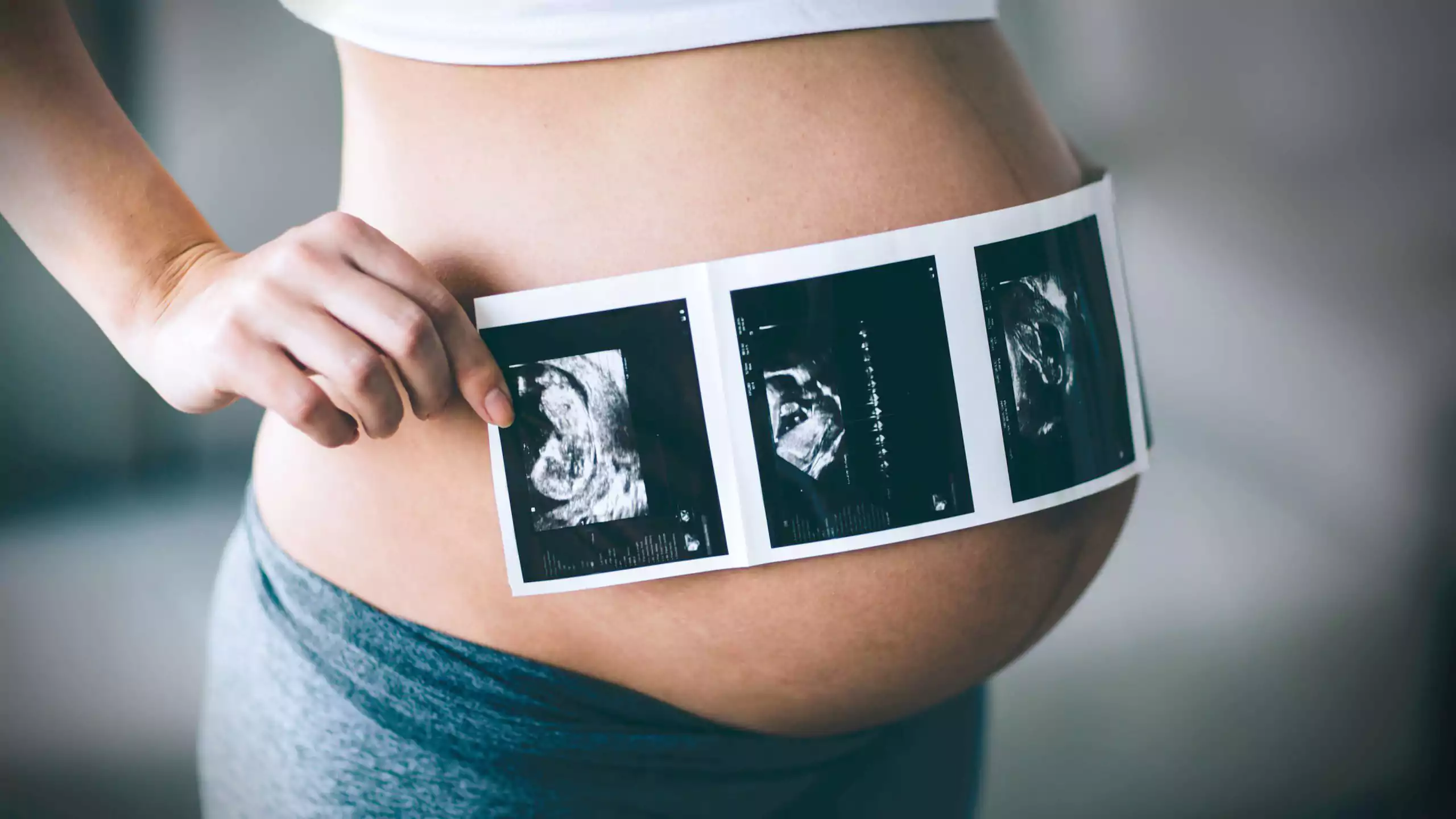 ضرورت انجام سونوگرافی NT در دوران بارداری چیست و چرا باید سونوگرافی NT انجام بدهیم ؟