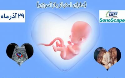 کنفرانس سونوگرافی پیشرفته جنین و اکوی قلب جنین