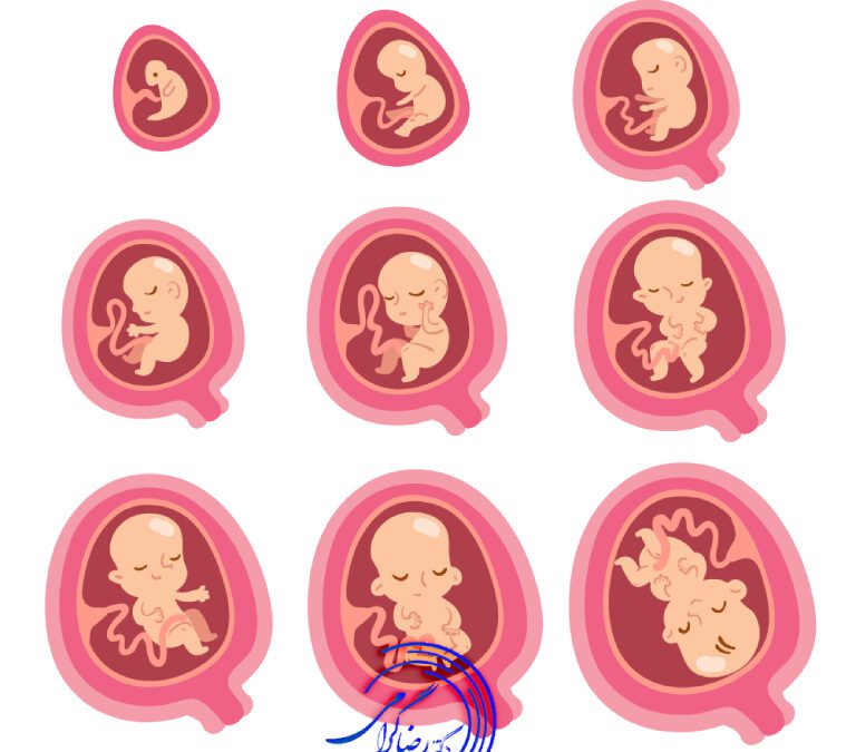 انواع جفت در زمان بارداری | قرارگیری جفت در زمان بارداری