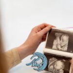 علت پیچیدن بند ناف دور گردن جنین | دکتر رضا گرامی